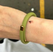 原来风油精还可以这样用 12个神奇生